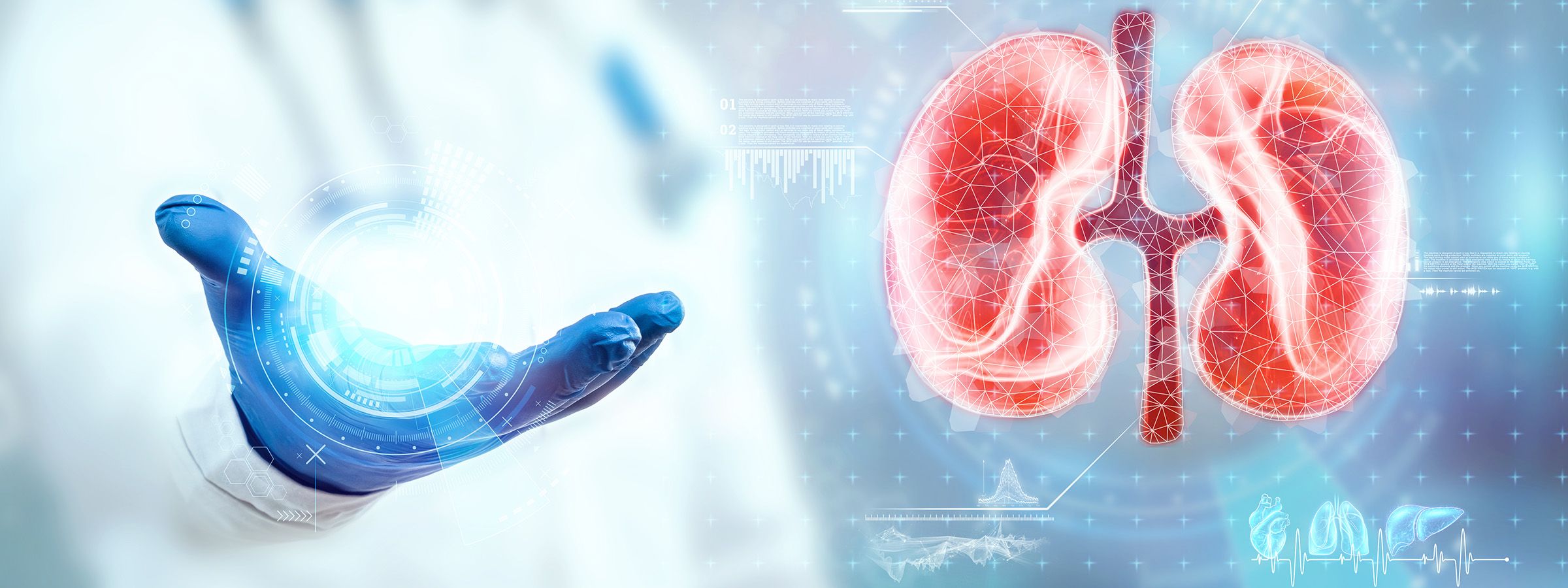 kidney care excellence 